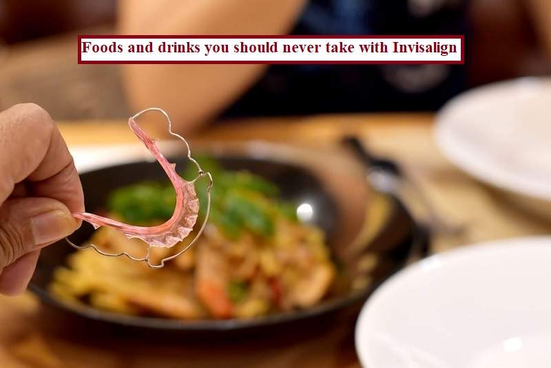 Foods and Drinks You Should Never Take With Invisalign