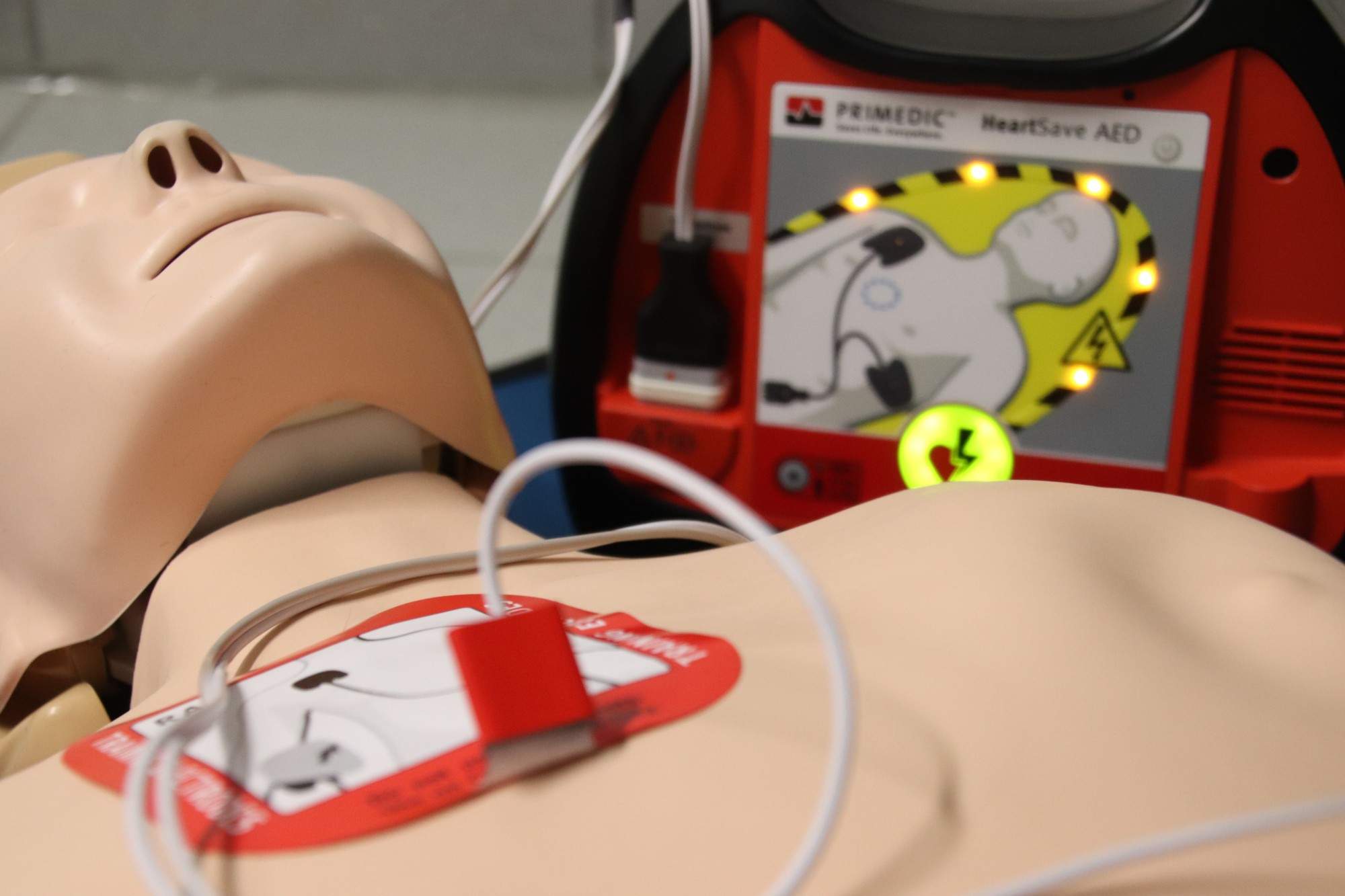 AED Pads: Guidelines for Proper Placement