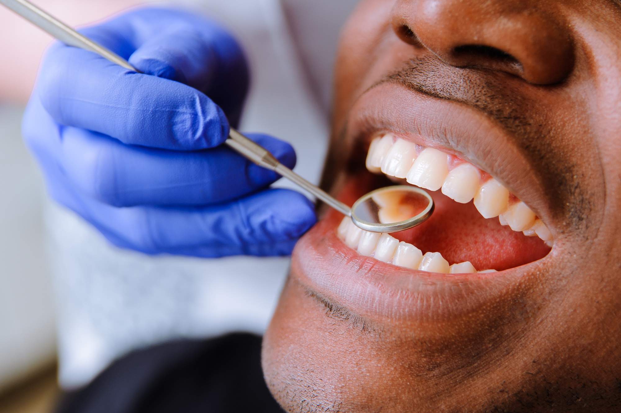 What Are the Different Types of Dental Treatments That Exist Today?