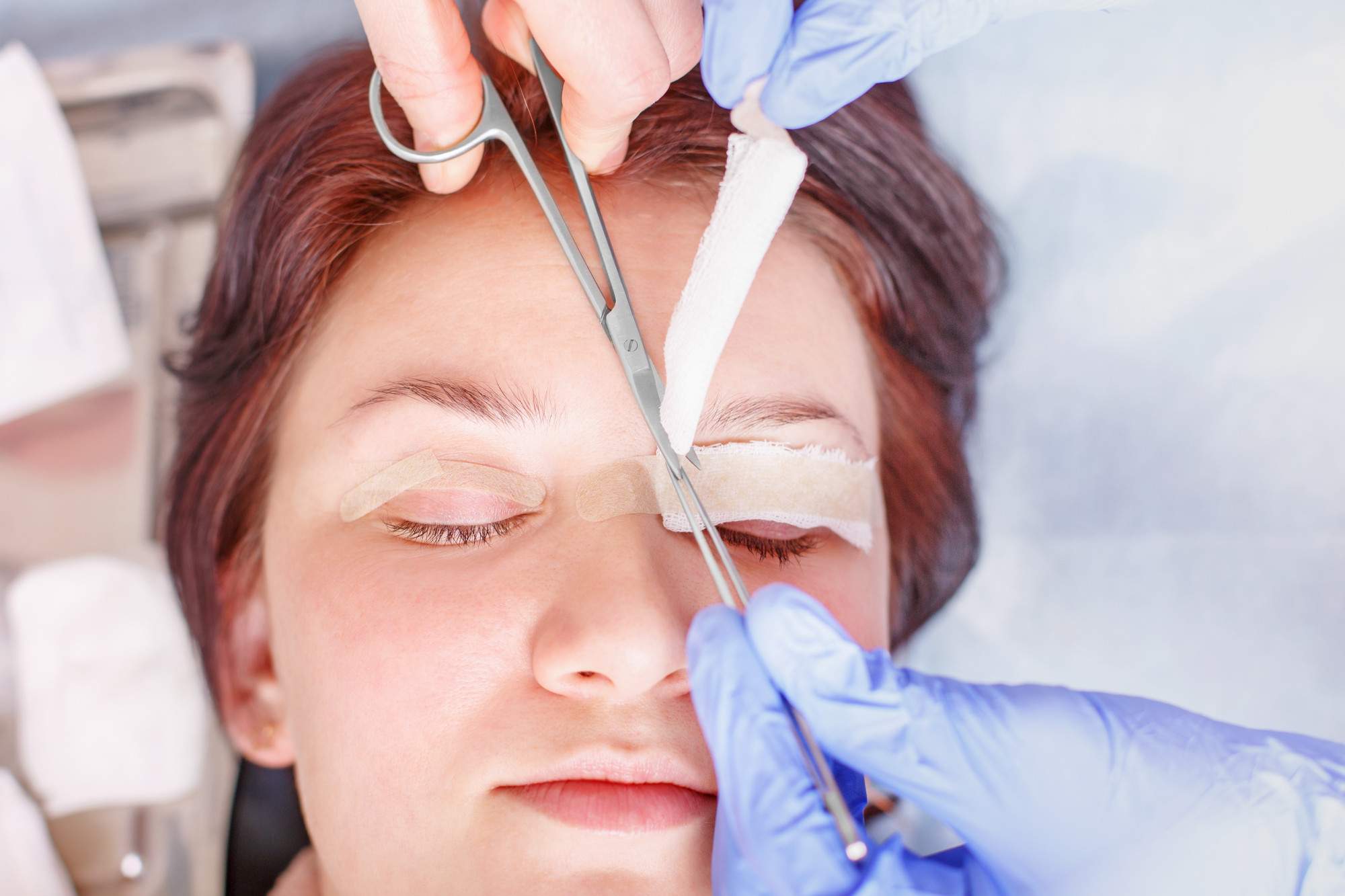 5 Factors to Consider Before Getting a Blepharoplasty