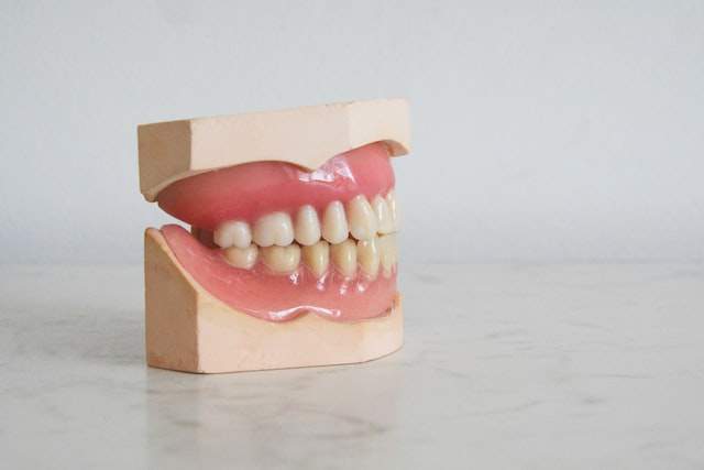 Straighten Your Teeth