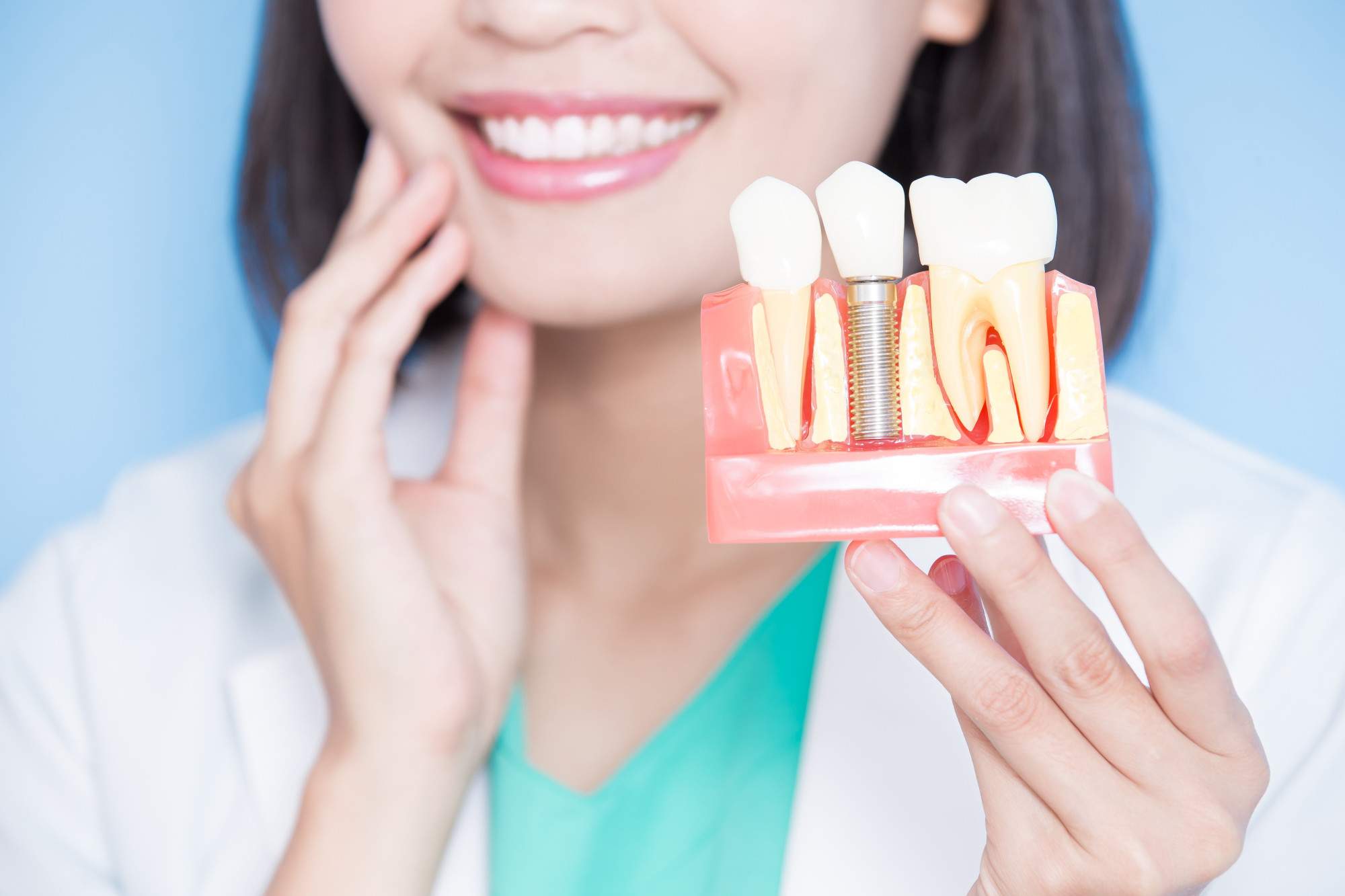 5 Questions to Ask Before Getting Dental Implants