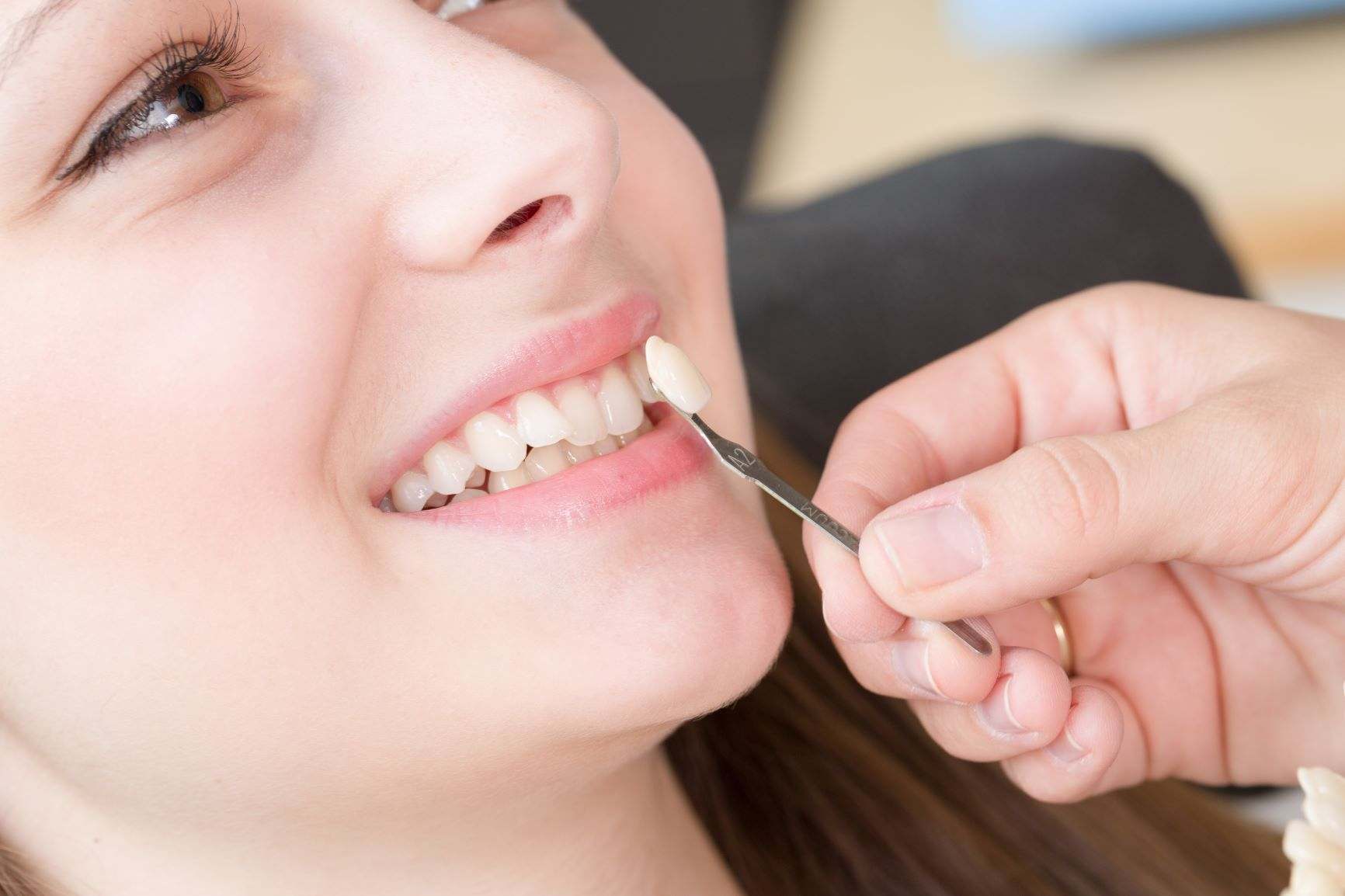 How Dentists Can Keep Your Smile Alive and Healthy?