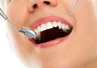 Understanding Teeth Whitening: Methods, Varieties, and Potential Risks